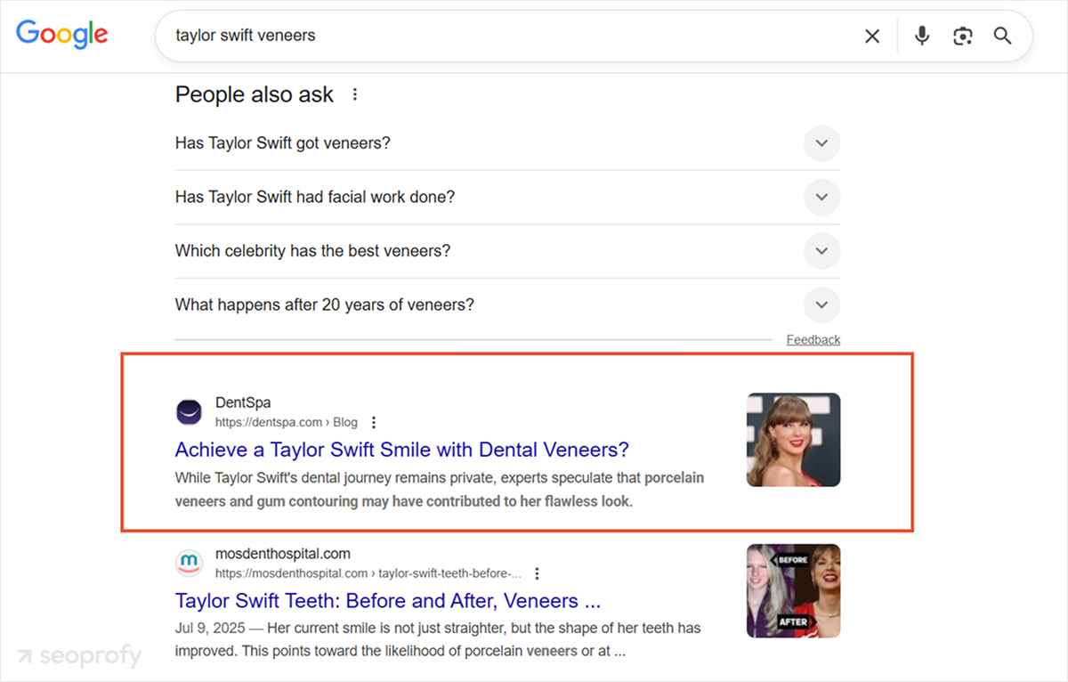 Article «Achieve a Taylor Swift Smile with Dental Veneers?»